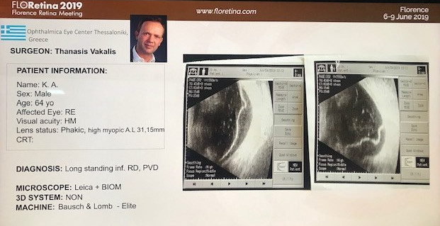 floretina live 3