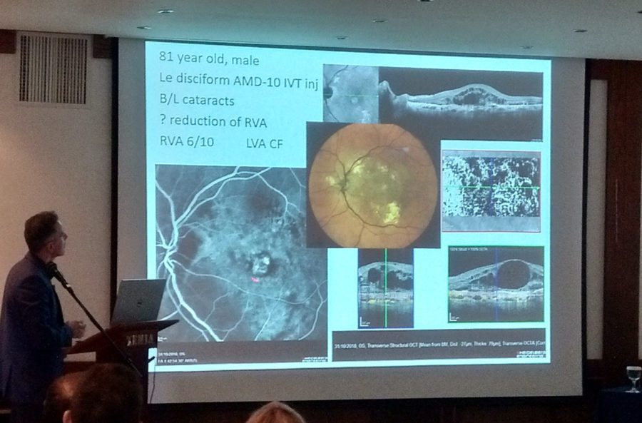 Το Ινστιτούτο Ophthalmica στην επιστημονική εκδήλωση της ΟΕΒΕ: Τελευταίες εξελίξεις στην οφθαλμολογία 10 portaria 3 3