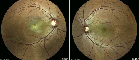 Case of the month (January 2021) 9 Fig. 1 HQ