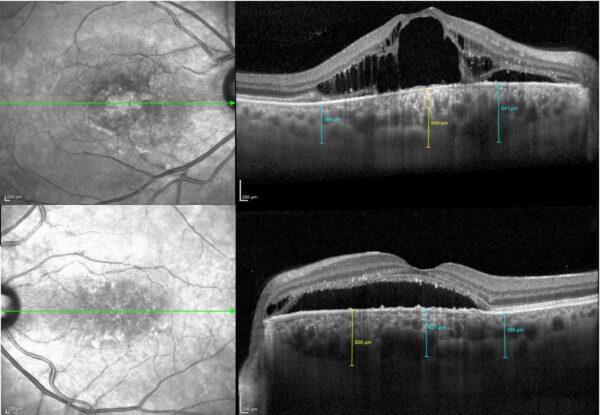 Case of the month (January 2021) 10 Fig. 2 HQ