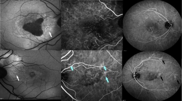 Case of the month (January 2021) 11 Fig. 3 HQ