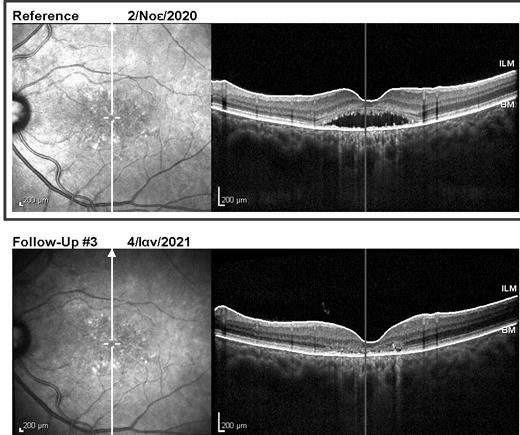 Case of the month (January 2021) 12 Fig. 4 HQ