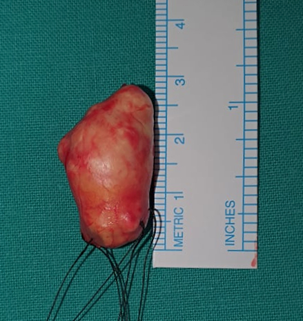 Fig. 3