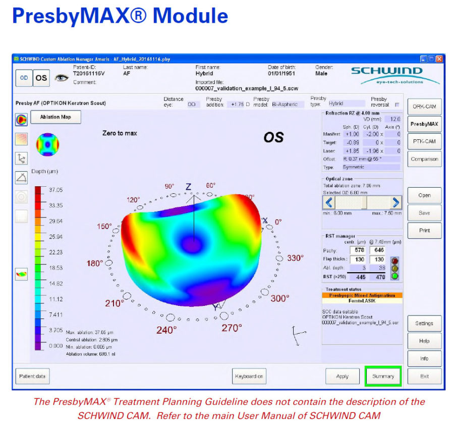 Schwind PresbyMAX: Visual acuity in all distances, Πέμπτη 08 Απριλίου 2021 και ώρα 15:00 11 presby 3