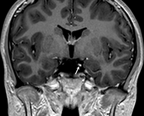 Fig. 2 HD