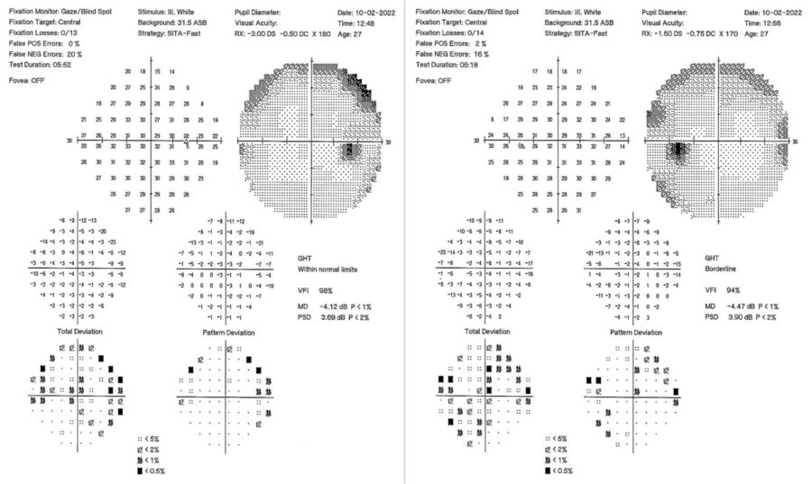 Fig. 2 HQ