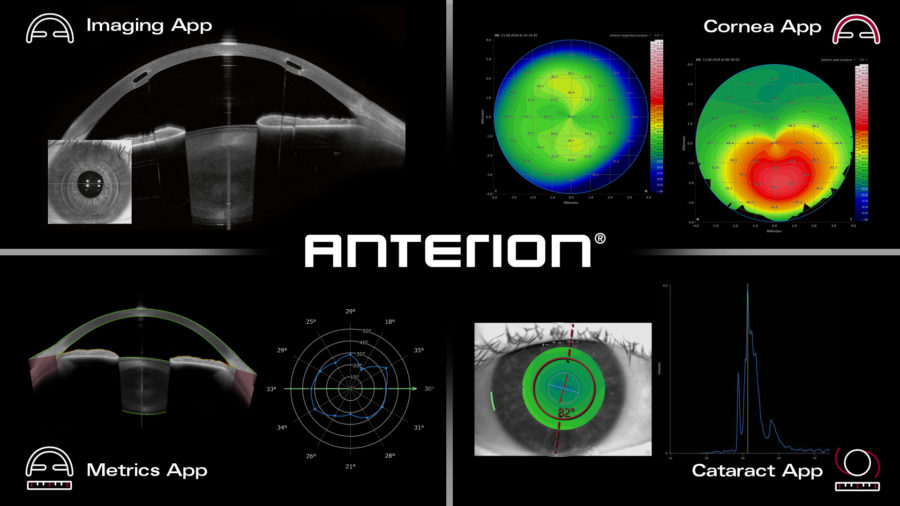Το Epithelial Thickness Module του συστήματος Heidelberg Anterion στο Ινστιτούτο Ophthalmica 6 anterion
