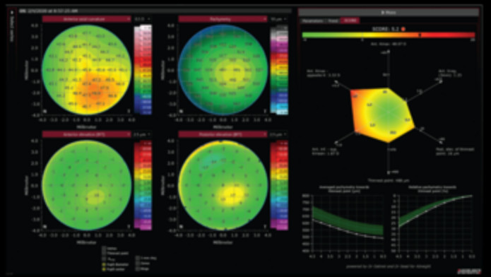 Το Epithelial Thickness Module του συστήματος Heidelberg Anterion στο Ινστιτούτο Ophthalmica 8 epi 2