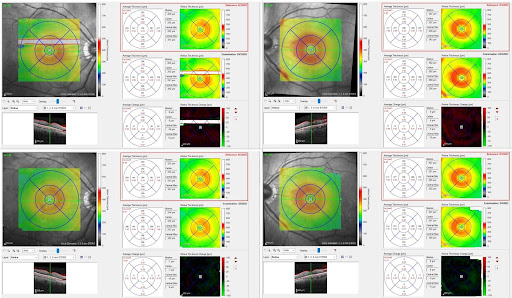 Fig. 3 HQ