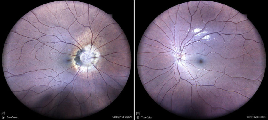 fig1