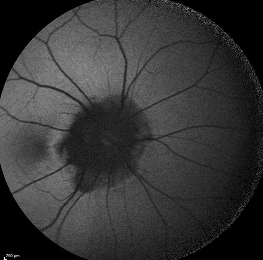 fig2
