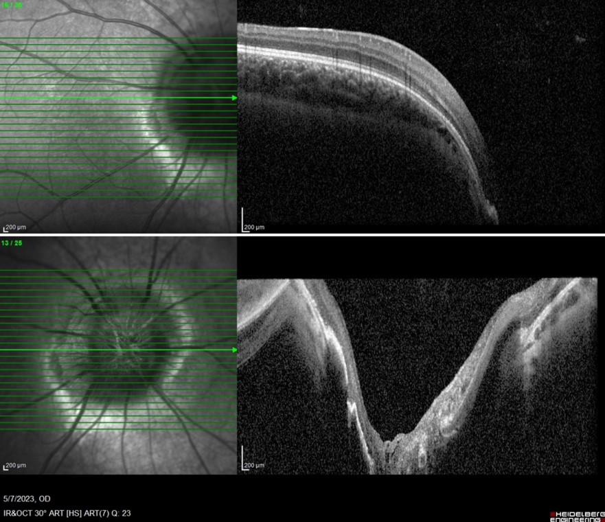 fig3