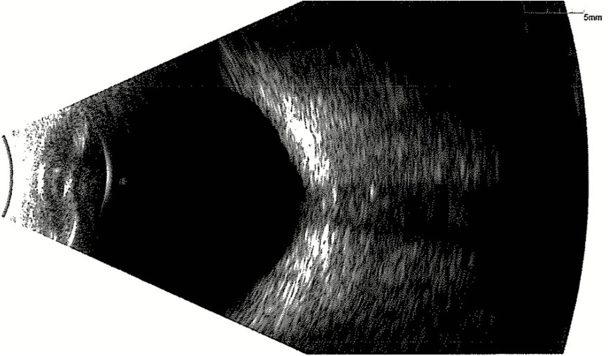 fig4