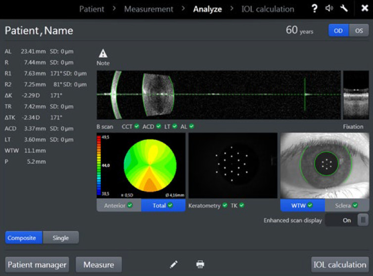 iolmaster 2
