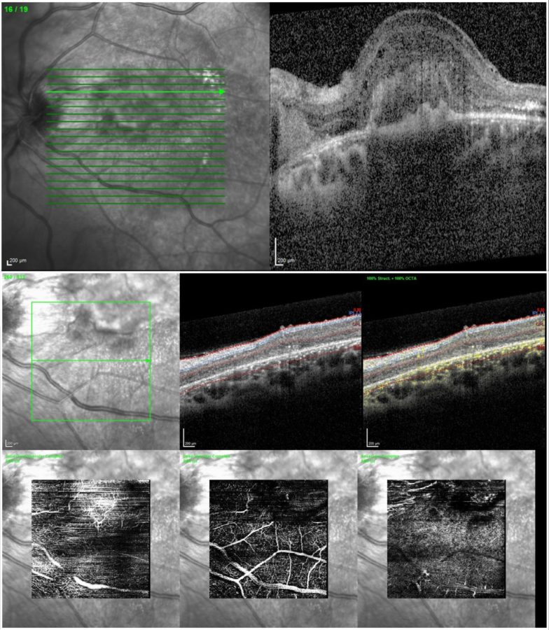 Fig. 7 HQ