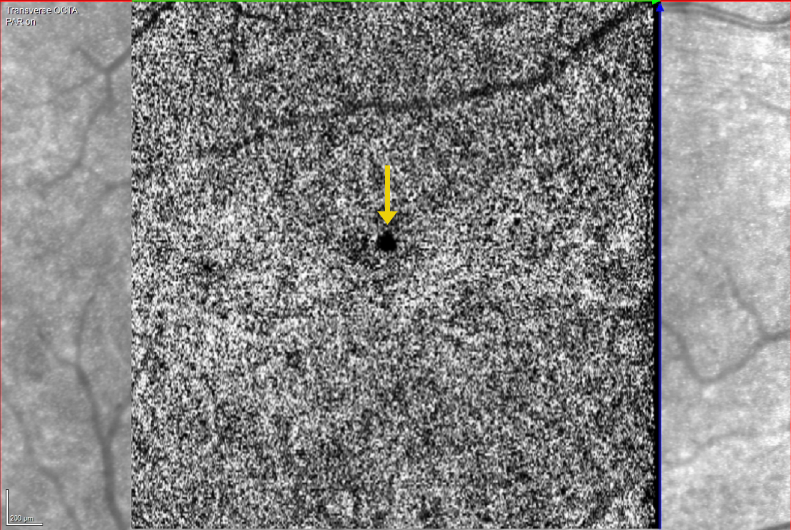 Fig. 3 HQ