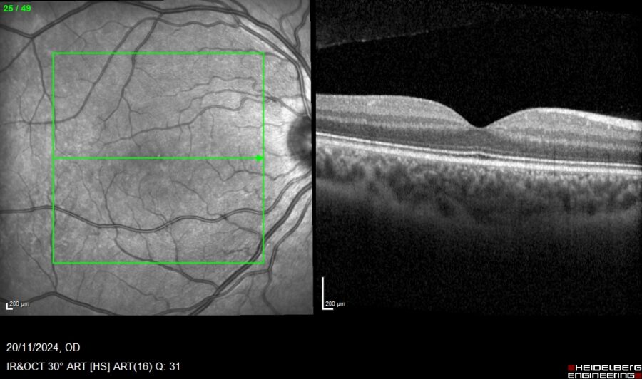 Fig. 4 HQ